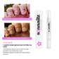 Stem Cells Nail Growth Pen